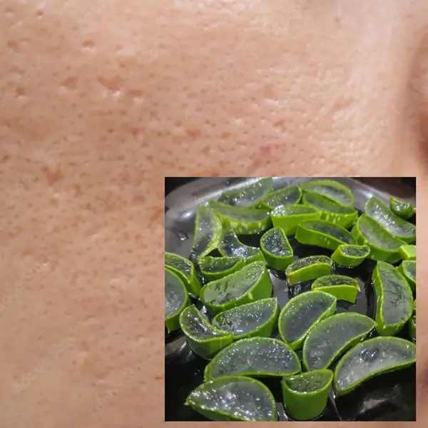 applying fresh aloe vera gel on face for natural skin healing and hydration